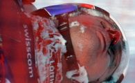 VIDEO / DRAMA LUI ALBRECHT! Vezi cum s-a accidentat schiorul care a intrat in coma!