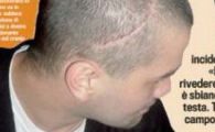 Medicii avertizeaza: "Chivu poate avea pierderi de memorie!"