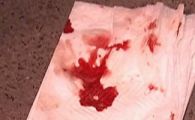 VIDEO:&nbsp;La un pas&nbsp;de un nou caz Cozma! Stelistii si dinamovistii, bataie ca-n filme! 2 rugbisti au fost batuti